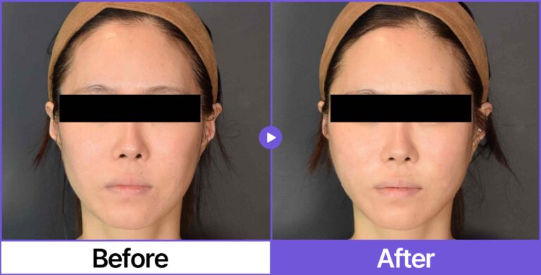 Silhouette soft: a comparison of a woman's face